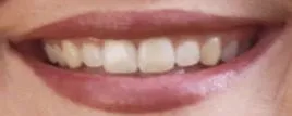 smile with white teeth