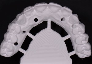 Denture mold