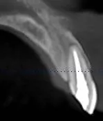 x-ray