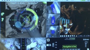 dental implant case study