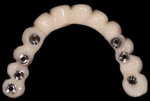 denture