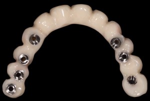 denture