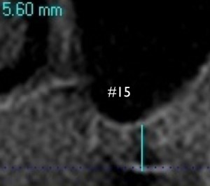 x-ray