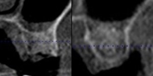 x-ray