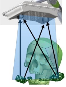 Dental implant equipment